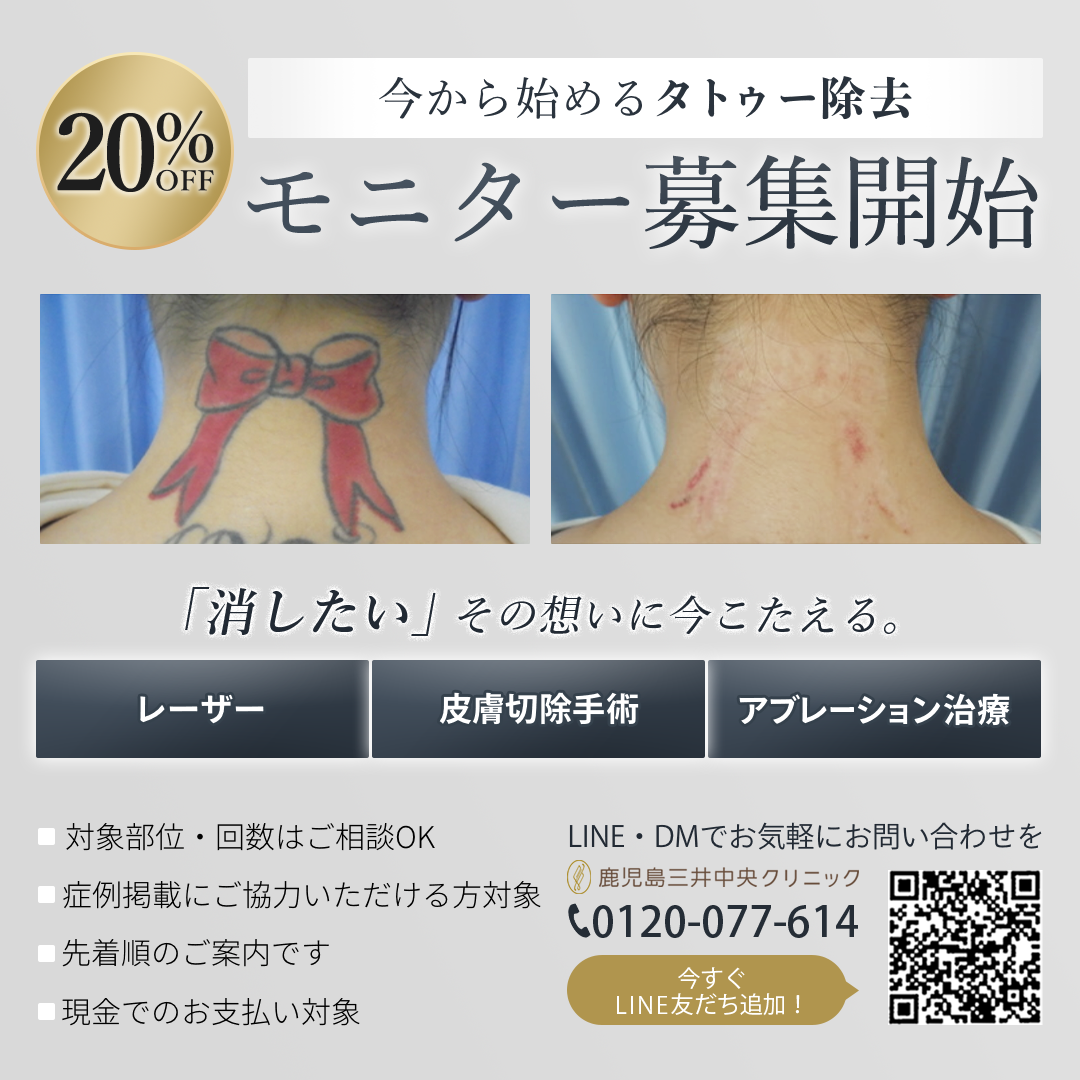 タトゥーモニター