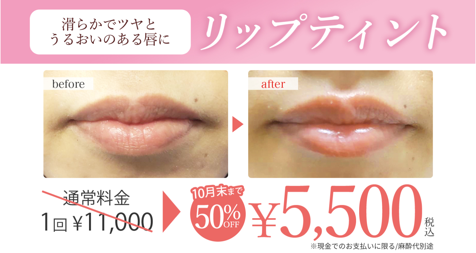 リップティント